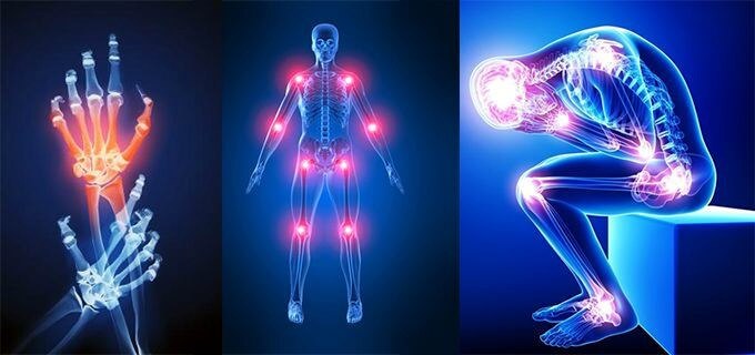 fibromiyalji-nedir-fibromiyalji-belirtileri-teshis-ve-tedavisi