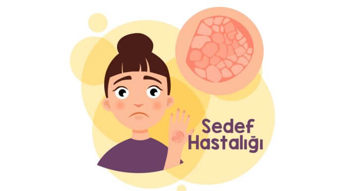 sedef