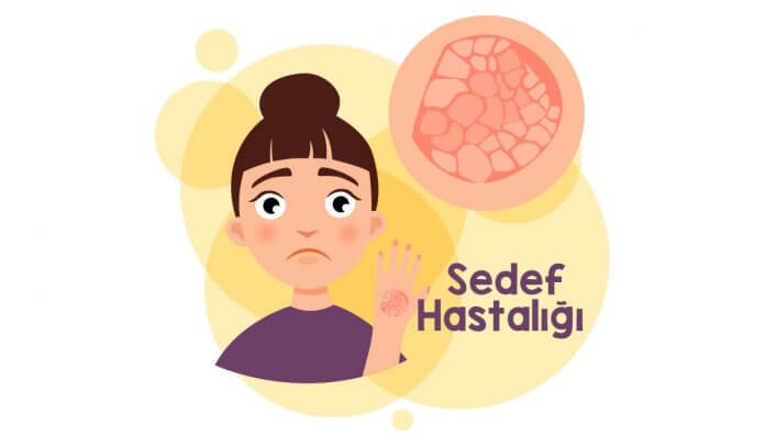 sedef