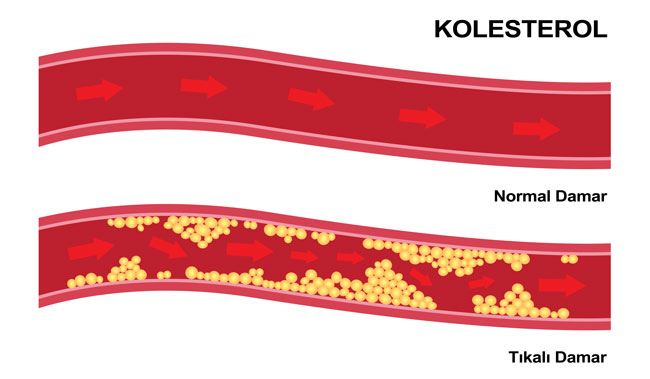kolesterol-nedir-neden-yukselir
