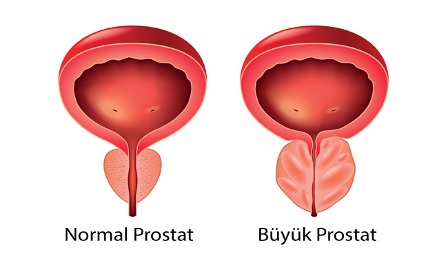maca-koku-nedir-faydalari-nelerdir